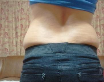 看看我现在的身材，赘肉这么多，别说老公不喜欢了，我感觉我自己都不怎么喜欢了，所以我决定去上海天大整形医院做整形做韩式3D吸脂术，刚开始的时候，我还很害怕，后来医生给我讲解后，解除了我许多疑问，所以我现在很有自信。