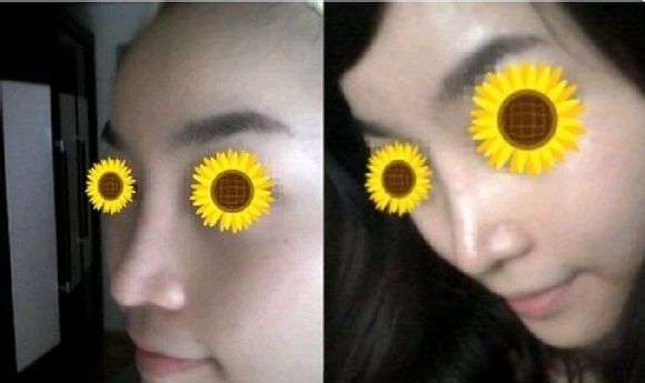 鼻子变挺了，侧面照也不怕了~
