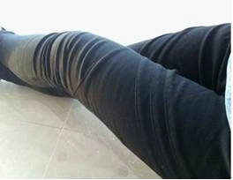 现在的样子奥…………虽然传的牛仔裤有些不时髦了，但还是阻挡不了我那迷人的瘦腿奥，周围的人都说我选择医院选的好。我真心感觉很骄傲。