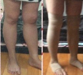 站着，这个明显吧！ 真是不枉我远赴韩国做整形啊，感觉很值的奥。