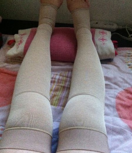 依然水肿着﹣0﹣
手术头3天要躺下来，不可以走太多
还要天天渴3L水，躺到人也累和痛