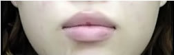 厚唇变薄