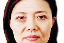 面部除皱前后对比图