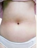 注射前后对比图