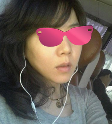 虽然还有一点点淤青，但是下巴弧度是那么的漂亮，我非常的满意。这张照片看上去很不错吧