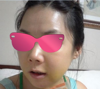 手术周的时候拍的照片~~~~~
我为了快速消肿，一直都有在坚持喝医院给的南瓜汁
