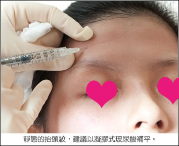 Snan术中。。。。。期待好结果~~~