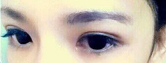 开始化妆了，等不及了~ 嘿嘿
但建议大家，术后一个月后化妆，不然恢复的速度很慢很慢的。。。本人表示真心后悔哦~