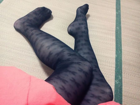 吸脂瘦腿经历~可以自信的穿短裙短裤了！