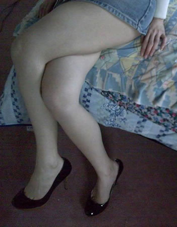 吸脂瘦腿经历~可以自信的穿短裙短裤了！