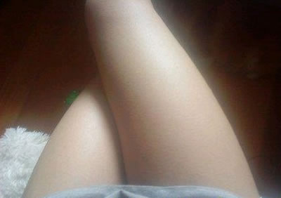 吸脂瘦腿经历~可以自信的穿短裙短裤了！