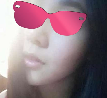 做了下巴整形~~糗美中~~~