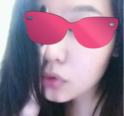 做了下巴整形~~糗美中~~~