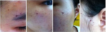 这是线头部位～　一共是6个地方