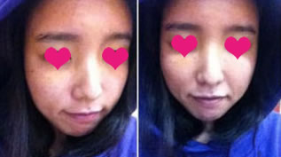 当时出门前照的~

本以为拆线的时候会疼~ 不过真的一点都不疼呢

这几天天吃南瓜粥- - 为了消肿没办法啦

拆线后去了面馆~ 我要吃米线~ 不想吃南瓜粥了

这时候没有比今天消肿，不过比刚开始还是好很多~

吃完面后，打算去逛逛街~

好久没出来逛了，我都快发霉了~
