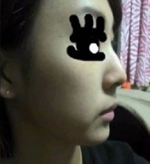 再给大家来张侧面的，是不是很丑啊？