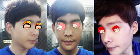 嗷嗷嗷~两个月后可以运动咯。去体育馆打球，电梯里面拍的。