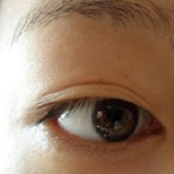 摆脱双眼皮贴，看我的埋线双眼皮效果如何