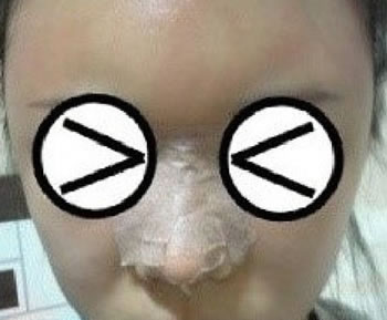 \(^o^)/~谁动了我的鼻子~~~