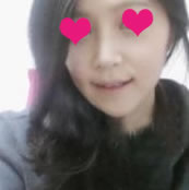 到医院后，医生先检查我的鼻子，给我推荐了韩式隆鼻术，说恢复的比较快，而且自然些。我就做了韩式隆鼻术。具体的手术方式跟一般隆鼻术是一样吧，细节上的东西，我不太了解。 

这是术后一个月

术后1个月