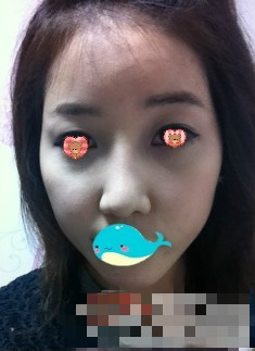 还没完全消肿。