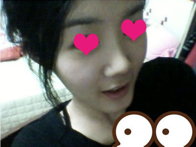 做了大腿吸脂+面部脂肪填充手术 立马小清新范儿了