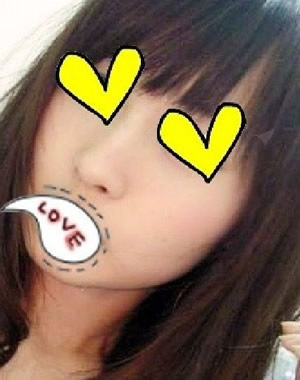 方下巴手术3个月后 美丽咯~~