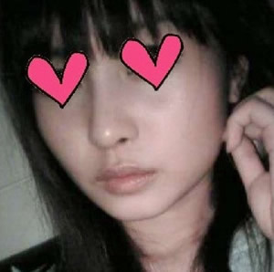 方下巴手术3个月后 美丽咯~~