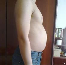 网友自述吸脂术摆脱了“将军肚”全过程  