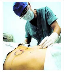 上面是医生为我做手术的照片，怎么样，很专业，很认真吧?还记得去医院咨询的时候，我很担心别人会认出我来，毕竟一个大男人来整形，自己还真有点接受不了，“没事的，现在男士做吸脂减肥很普遍，而且像你这种因为平常坐着办公，缺乏运动造成腹部脂肪堆积的情况更是常见，不过你放心，通过咱院的腰腹部吸脂就能帮你解决问题”，医生的话让我放下了心，于是我的减肥历程开始了!

　　沟通、检查、拍照，换手术衣，进入手术室后，整形医生在我的腰腹部标记出要吸脂的范围，接下来是消毒，打麻醉，不知道是不是放松的缘故，反正我没感觉到疼痛，大概一个小时的时间吧，手术就结束了，看到那抽出的一大瓶脂肪，真是恶心啊!!!