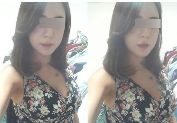 术后11月，前两天刚去海滩，好像晒黑了~但我还是很欢乐哦，嘿嘿!颧骨变低了，感觉气质就变了!有木有?
 