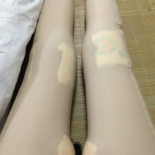 腿部吸脂，我离女神近了一步，哈哈