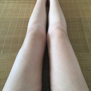 腿部吸脂，我离女神近了一步，哈哈