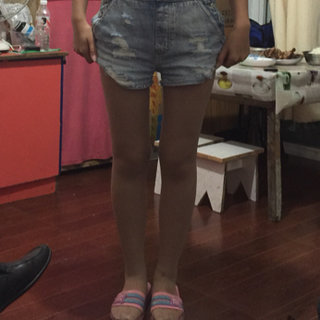 腿部吸脂，我离女神近了一步，哈哈