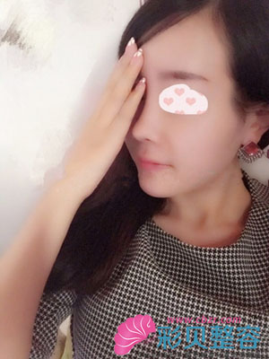 但是侧面很美有木有~~~弧度和高度都很自然我也很喜欢，就是正面。强迫症呀~~~
 小伙伴们快告诉我鼻尖好看不！