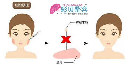 瘦脸针 自拍上镜开挂神器