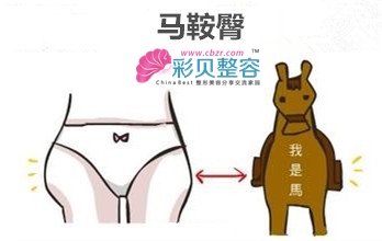 马鞍臀怎么破?这个方法要get