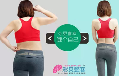 吸脂前后对比图