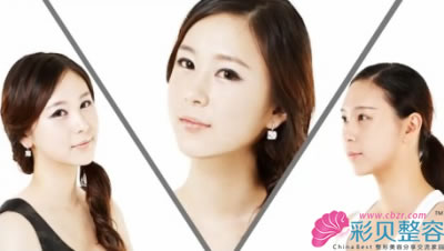 vline矫正不同脸型