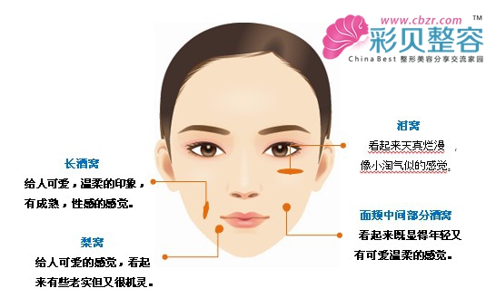 人造酒窝让你的笑容不再迟到