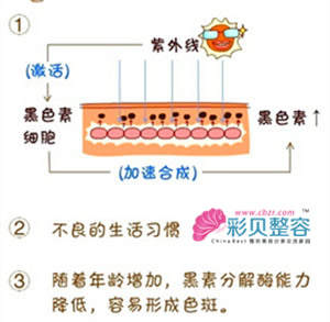 光子对的黑色素产生原因