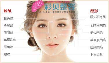 自体脂肪面部填充功能