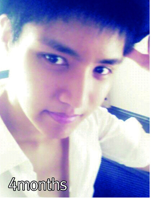 4个月后恢复的已经很不错了，有没有被电到呢~