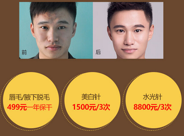 脱毛优惠价格