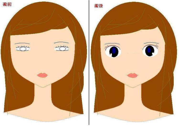 美容手术一辈子都能管理？