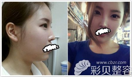 武汉中翰整形美容医院真人实例