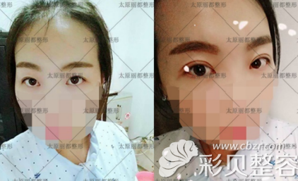 太原丽都杨明锋冰冰媚眼真人案例 太原丽都杨明锋冰冰媚眼真人案例