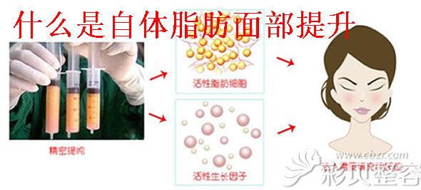 什么是自体脂肪面部填充
