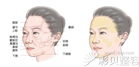 面部容易出现皮肤衰老的部位