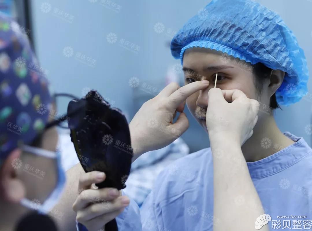 华美何春涛医生设计双眼皮手术方案